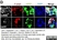 Anti Human Amylin Antibody, clone R10/99 thumbnail image 2
