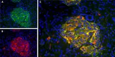 Anti Human Amylin Antibody, clone R10/99 gallery image 3