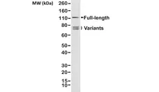Anti Androgen Receptor Antibody, clone RM254 gallery image 1