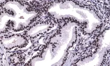 Anti Androgen Receptor Antibody, clone RM254 gallery image 2