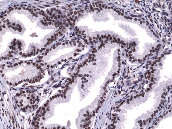 Anti Androgen Receptor Antibody, clone RM254 gallery image 2