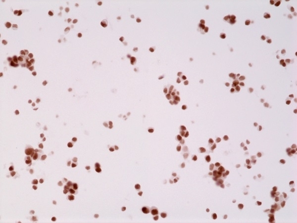 Anti Androgen Receptor Antibody, clone RM254 gallery image 3