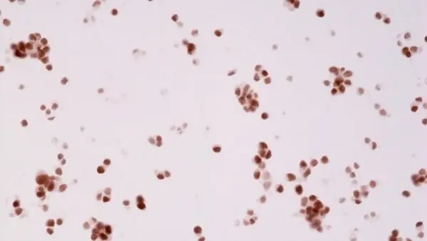 Anti Androgen Receptor Antibody, clone RM254 gallery image 3