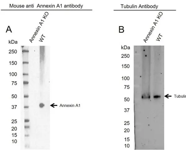 Anti Annexin A1 Antibody, clone CPTC22 (PrecisionAb Monoclonal Antibody) gallery image 2