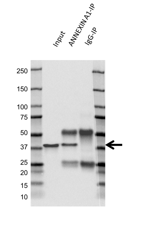 Anti Annexin A1 Antibody, clone CPTC22 (PrecisionAb Monoclonal Antibody) gallery image 4