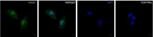 Anti Annexin A1 Antibody, clone CPTC22 (PrecisionAb Monoclonal Antibody) gallery image 5