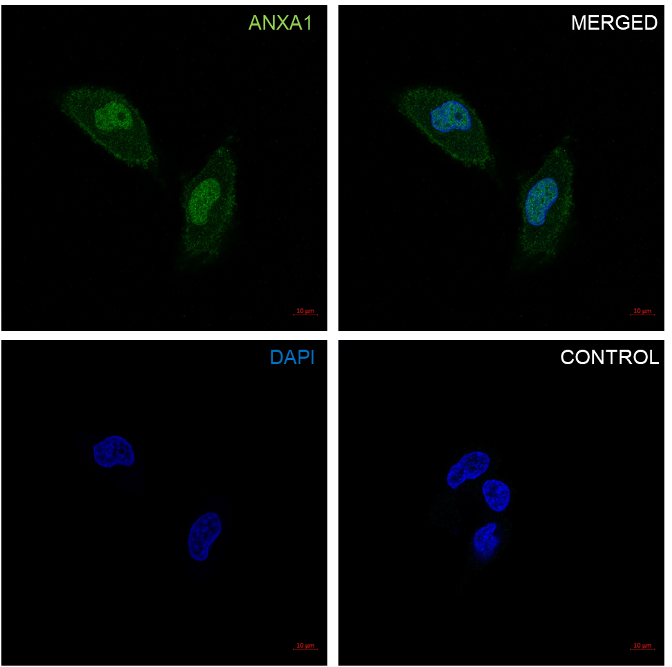 Anti Annexin A1 Antibody, clone CPTC22 (PrecisionAb Monoclonal Antibody) gallery image 5