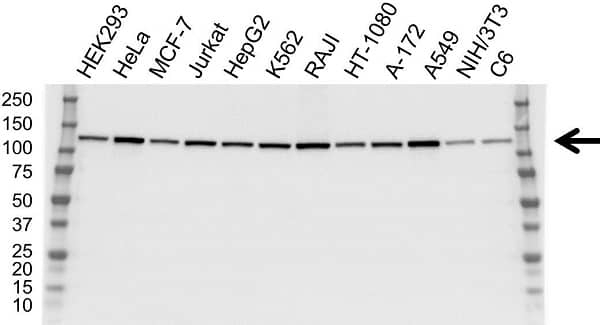 Anti ATP Citrate Lyase Antibody, clone 5F8D11 (PrecisionAb Monoclonal Antibody) gallery image 1