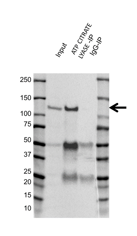 Anti ATP Citrate Lyase Antibody, clone 5F8D11 (PrecisionAb Monoclonal Antibody) gallery image 2