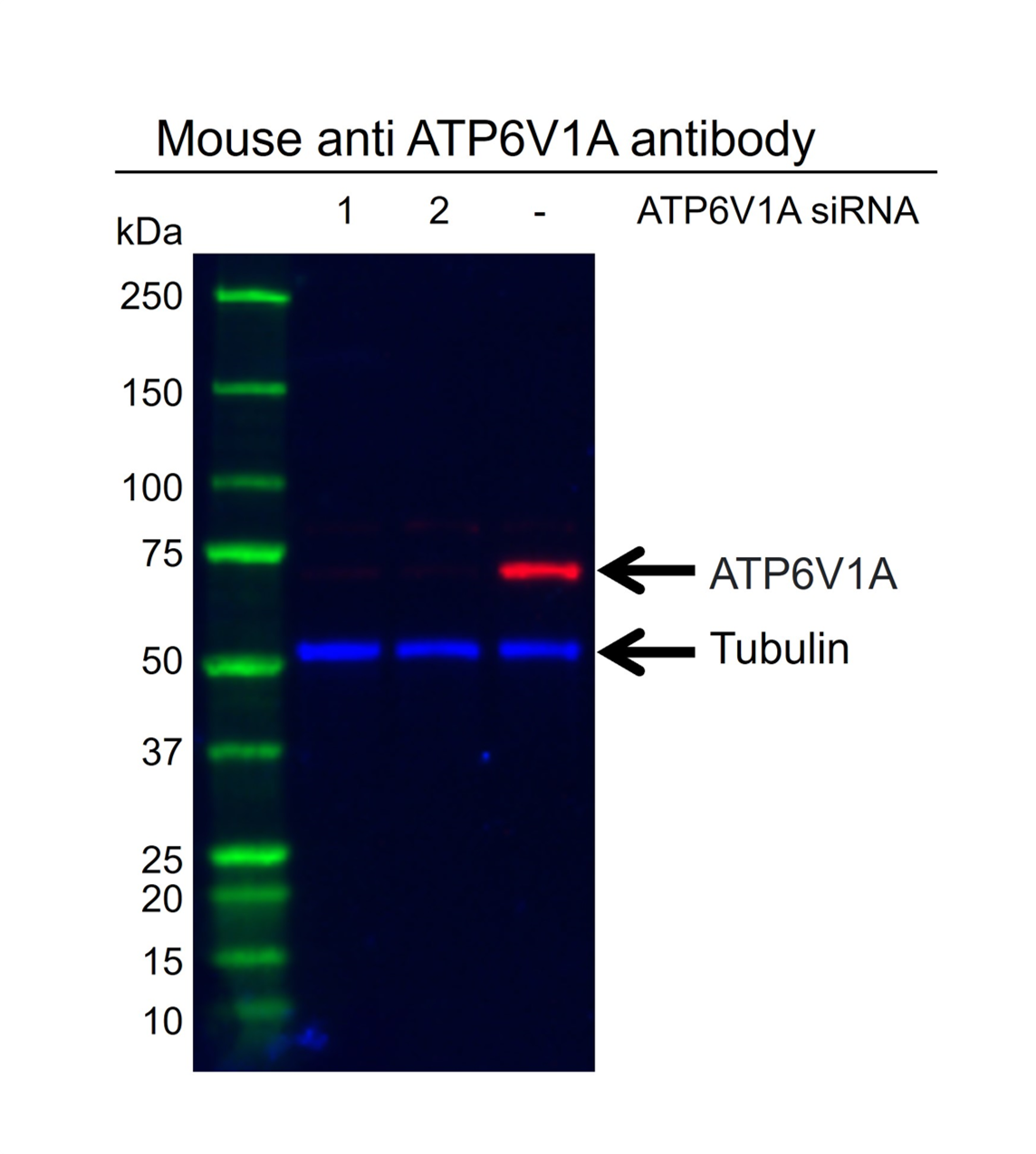 Anti ATP6V1A Antibody, clone AB01/4F4 (PrecisionAb Monoclonal Antibody) gallery image 3