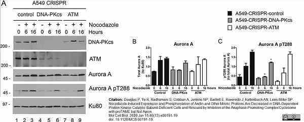 Anti Aurora-A Kinase Antibody, clone 35C1 gallery image 8