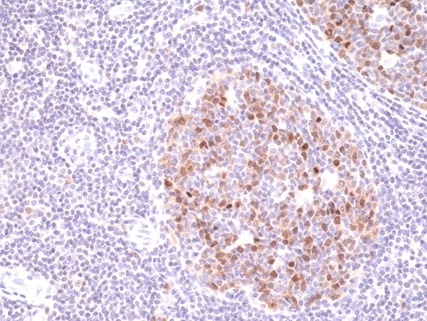 Anti Aurora-B Kinase Antibody, clone RM278 thumbnail image 2