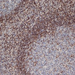 Anti Human Bcl-2 Antibody, clone 100 (Monoclonal Antibody Antibody) gallery image 1