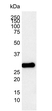 Anti Human Bcl-2 Antibody, clone 100 (Monoclonal Antibody Antibody) thumbnail image 2