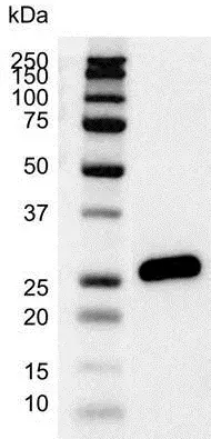 Anti Human Bcl-2 Antibody, clone 100 (Monoclonal Antibody Antibody) gallery image 3