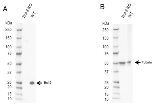 Anti Human Bcl-2 Antibody, clone 100 (Monoclonal Antibody Antibody) gallery image 4