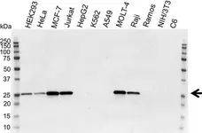 Anti Human Bcl-2 Antibody, clone 100 (Monoclonal Antibody Antibody) gallery image 6