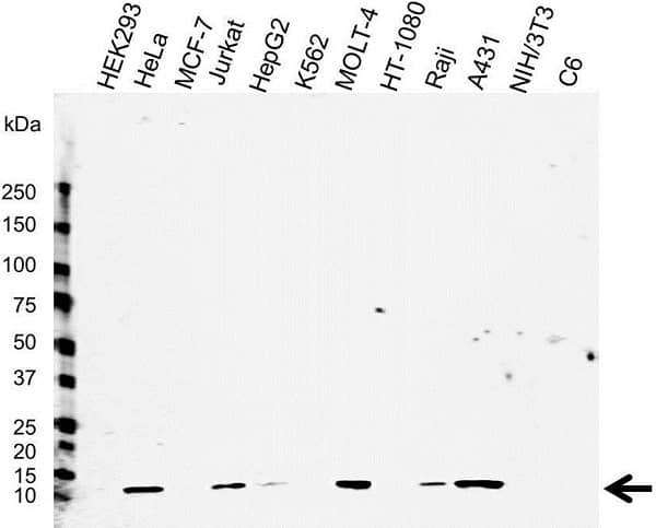 Anti Human Beta 2 Microglobulin Antibody, clone 2213 (Monoclonal Antibody Antibody) gallery image 1