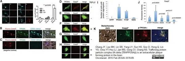 Anti Human Beta Amyloid (aa1-17) Antibody, clone DE2B4 gallery image 2