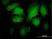 Anti Human Beta Arrestin-2 Antibody, clone 4D2 thumbnail image 2
