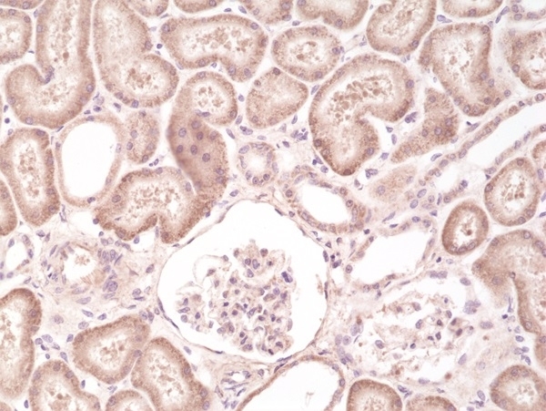 Anti Braf Antibody, clone RM308 thumbnail image 2