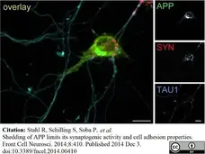 Anti c-Myc Antibody, clone JAC6 gallery image 1