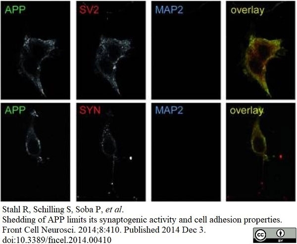 Anti c-Myc Antibody, clone JAC6 thumbnail image 2