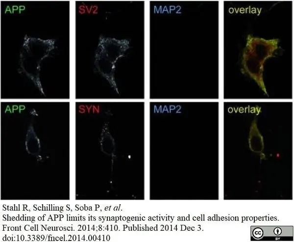 Anti c-Myc Antibody, clone JAC6 gallery image 2