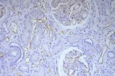 Anti Human C4d Antibody, clone 10-11 gallery image 1