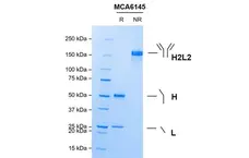 Anti C5 (Eculizumab Biosimilar) Antibody, clone h5G1.1 gallery image 1