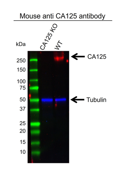 Anti CA125 Antibody (PrecisionAb Monoclonal Antibody) gallery image 2
