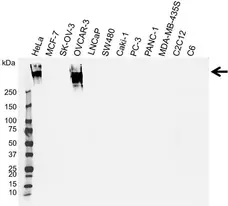 Anti CA125 Antibody, clone X325 (PrecisionAb Monoclonal Antibody) gallery image 1