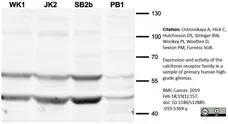 Anti Human Calcitonin Receptor Antibody, clone 31/01-1H10-4-1-14 gallery image 1