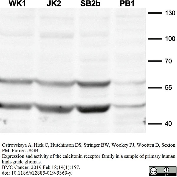 Anti Human Calcitonin Receptor Antibody, clone 31/01-1H10-4-1-14 gallery image 1