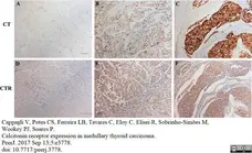 Anti Human Calcitonin Receptor Antibody, clone 31/01-1H10-4-1-14 gallery image 2