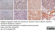 Anti Human Calcitonin Receptor Antibody, clone 31/01-1H10-4-1-14 gallery image 3