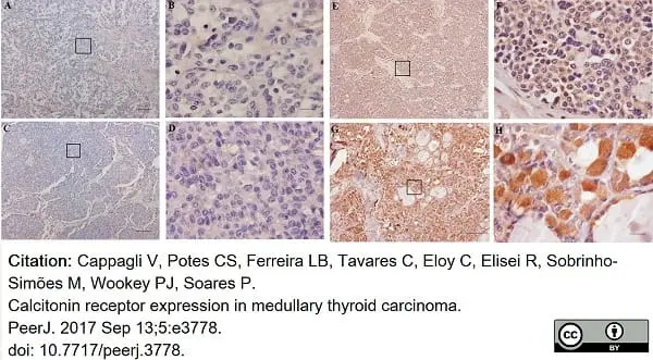 Anti Human Calcitonin Receptor Antibody, clone 31/01-1H10-4-1-14 gallery image 3