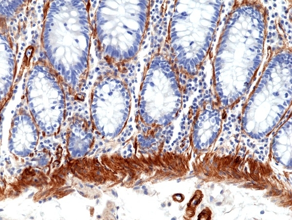 Anti CALD1 Antibody, clone RM396 gallery image 2