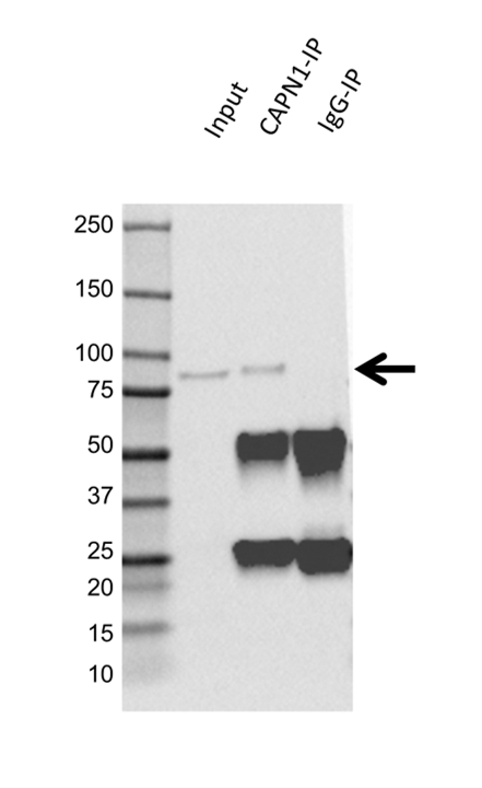 Anti CALPAIN-1 Antibody, clone 1376CT809.24.85 (PrecisionAb Monoclonal Antibody) gallery image 2