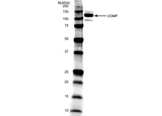 Anti Human Cartilage Oligomeric Matrix Protein Antibody, clone MA37C94 (HC484D1) gallery image 1