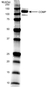 Anti Human Cartilage Oligomeric Matrix Protein Antibody, clone MA37C94 (HC484D1) thumbnail image 1