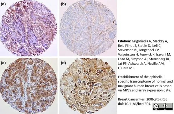 Anti Human Cartilage Oligomeric Matrix Protein Antibody, clone MA37C94 (HC484D1) gallery image 2