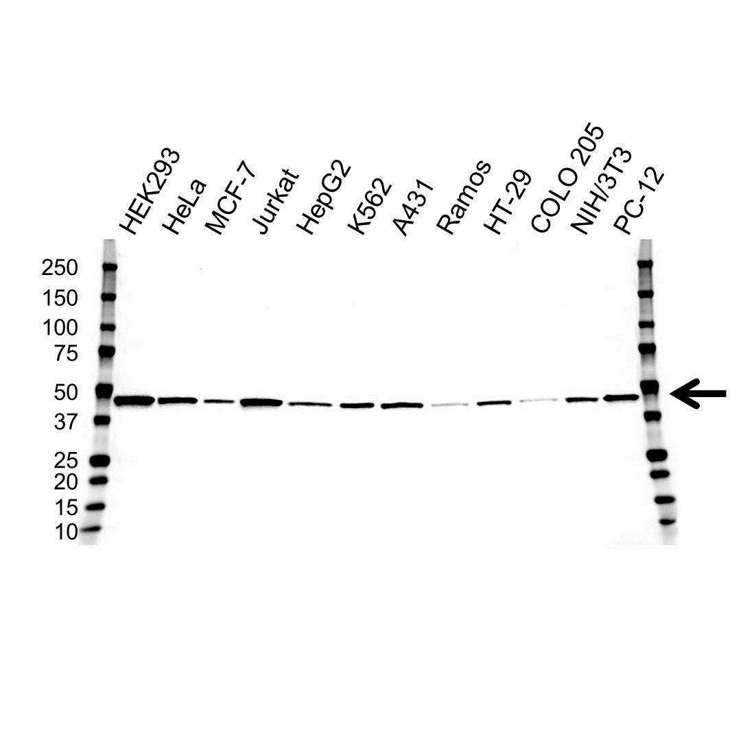 Anti Casein Kinase 1 Epsilon Antibody, clone OTI5C9 (PrecisionAb Monoclonal Antibody) gallery image 1