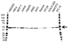 Anti Casein Kinase 1 Epsilon Antibody, clone OTI5C9 (PrecisionAb Monoclonal Antibody) gallery image 1