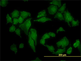 Anti Human Casein Kinase 2 Alpha Antibody, clone 3D9 gallery image 2
