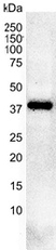 Anti Casein Kinase 2 Alpha 1 Antibody, clone AbD05928 thumbnail image 2