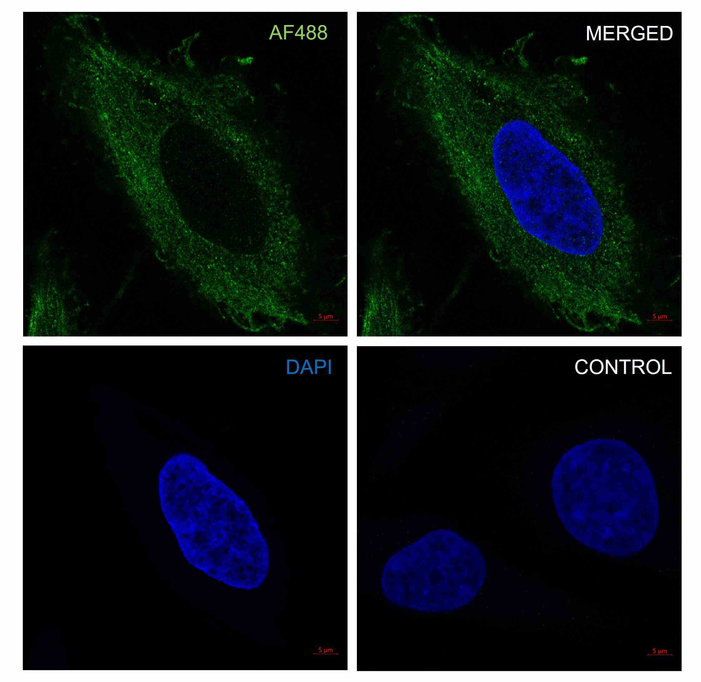 Anti Catenin Beta Antibody, clone AB05/1D4 (PrecisionAb Monoclonal Antibody) gallery image 4