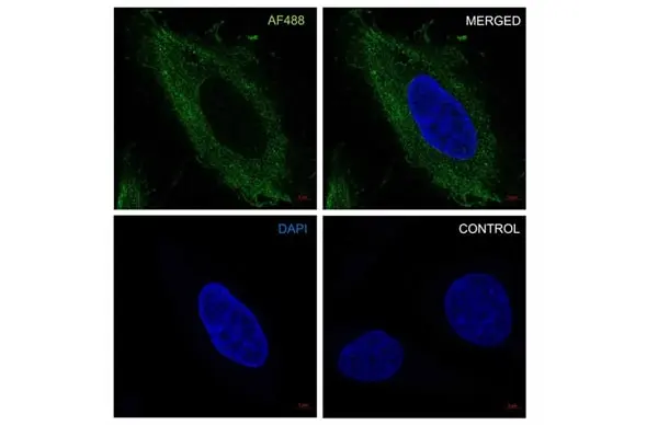 Anti Catenin Beta Antibody, clone AB05/1D4 (PrecisionAb Monoclonal Antibody) gallery image 4