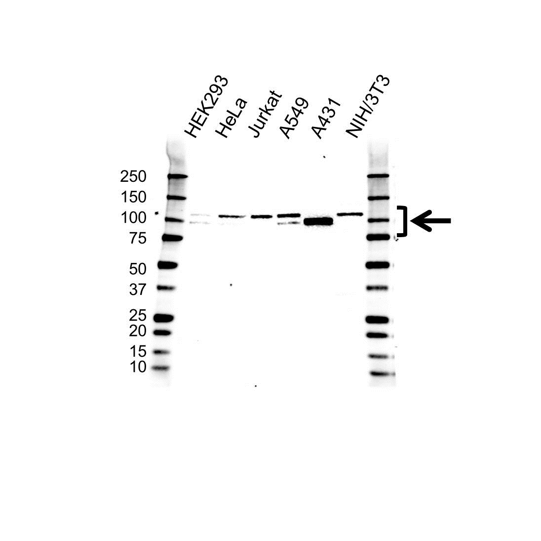 Anti Catenin Delta 1 Antibody, clone OTI2E8 (PrecisionAb Monoclonal Antibody) gallery image 1