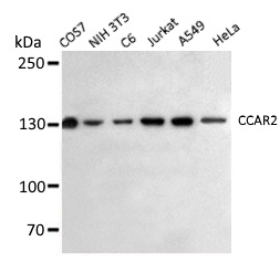 Anti CCAR2 Antibody, clone 3G4-D11-D7 gallery image 1